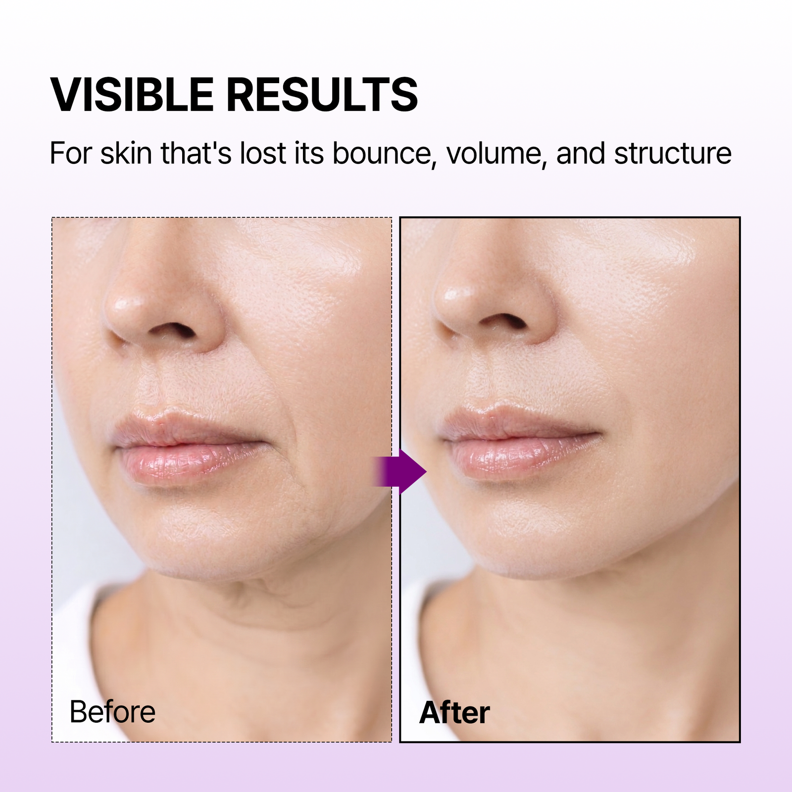 Calcium Bonding Serum - Image 3